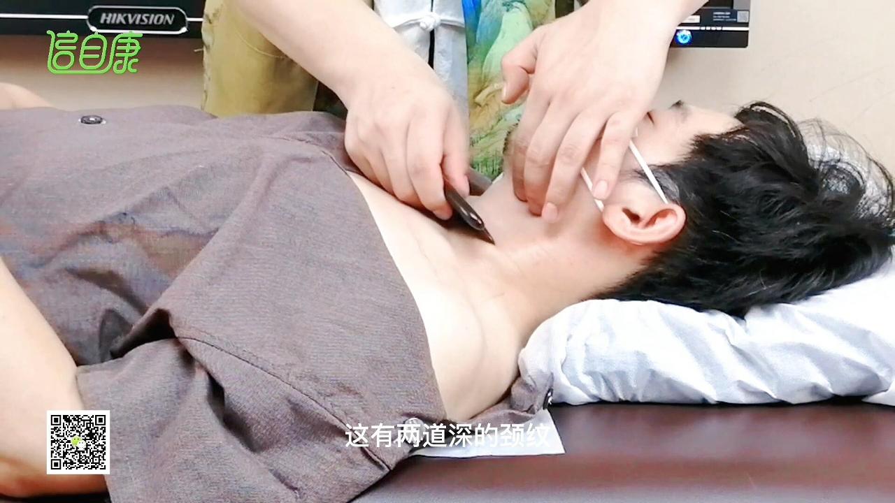 颈阔肌
